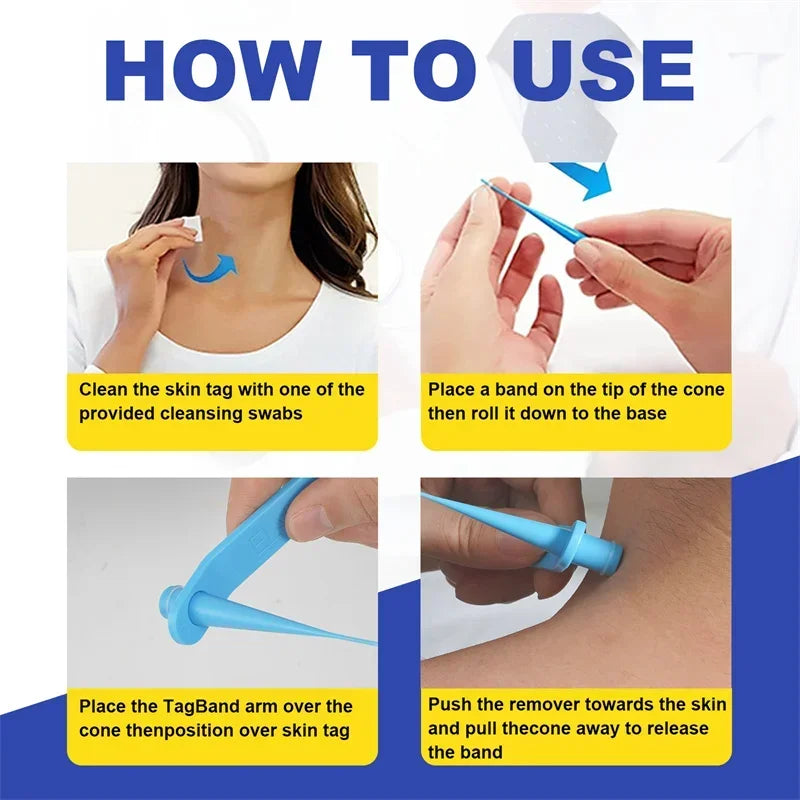 Skin Tag Removal Kit Skin Mole Wart Remover Micro Band Skin Tag Removal Kit Tag Treatment Tools Set with Cleansing Swabs Facial