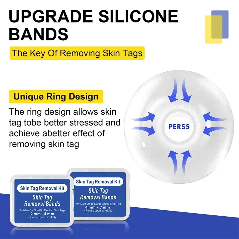 Skin Tag Removal Kit Skin Mole Wart Remover Micro Band Skin Tag Removal Kit Tag Treatment Tools Set with Cleansing Swabs Facial