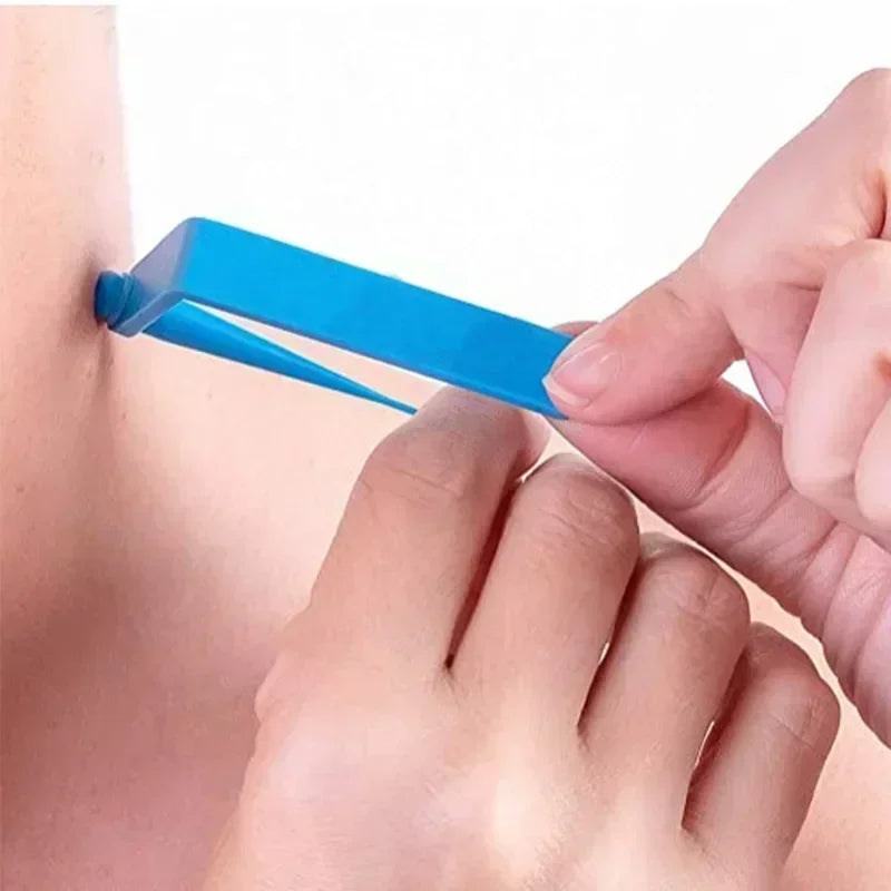 Skin Tag Removal Kit Skin Mole Wart Remover Micro Band Skin Tag Removal Kit Tag Treatment Tools Set with Cleansing Swabs Facial