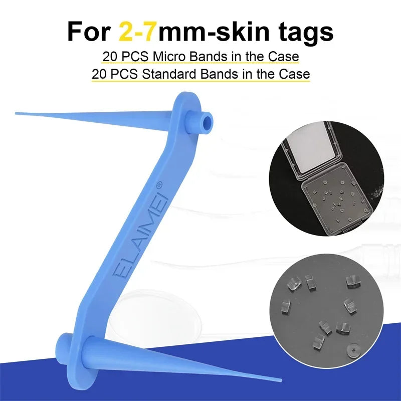 Skin Tag Removal Kit Skin Mole Wart Remover Micro Band Skin Tag Removal Kit Tag Treatment Tools Set with Cleansing Swabs Facial