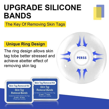 Skin Tag Removal Kit Skin Mole Wart Remover Micro Band Skin Tag Removal Kit Tag Treatment Tools Set with Cleansing Swabs Facial