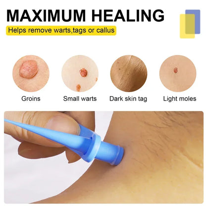Skin Tag Removal Kit Skin Mole Wart Remover Micro Band Skin Tag Removal Kit Tag Treatment Tools Set with Cleansing Swabs Facial